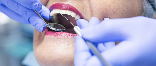 Best Emergency Dental Extractions in Elburn, IL
