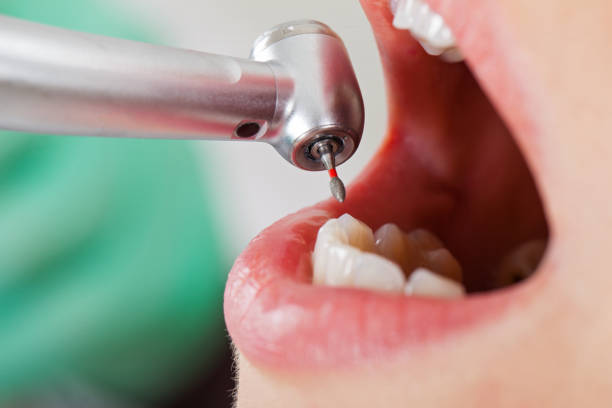 Best Pediatric Emergency Dentist in Elburn, IL